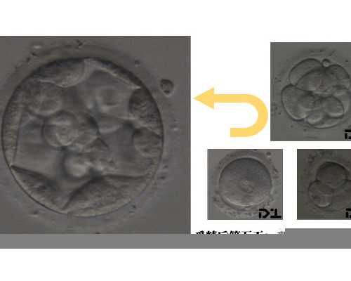 广州赴美助孕生子机构已公布(广州合法的助孕机构)