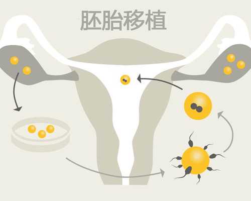 广州代怀孕哪里找,成都华西附二院试管婴儿收费是怎么算的-医生怎么看出男孩
