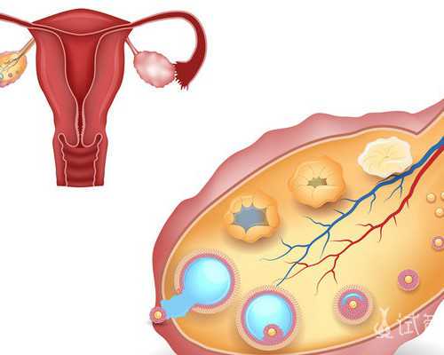 子宫腺肌症取卵难难难 供卵代怀生子公司