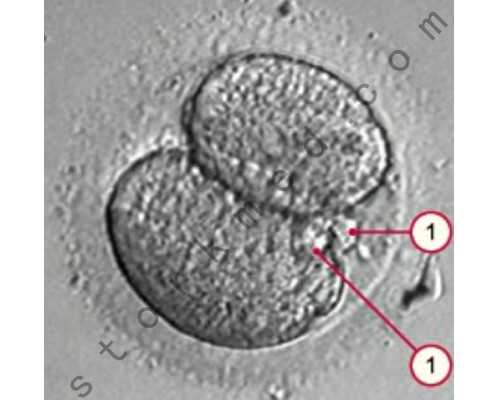 广州有供卵的医院是哪一家,广州供卵试管要求-代孕哪个正规