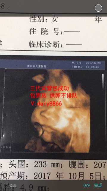 苏州代生捐卵_泰国试管婴儿移植内膜标准是怎样？哪种形态最佳？