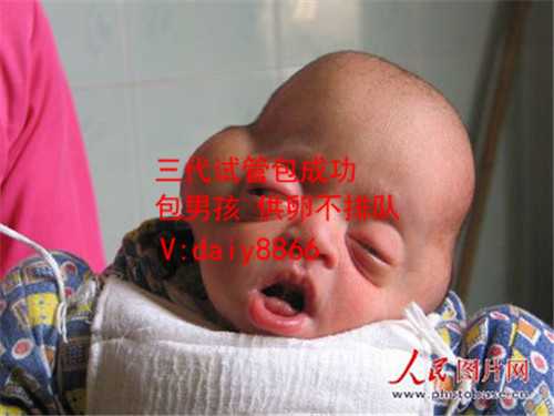 广东私立供卵_北京试管婴儿的价格会不会很高