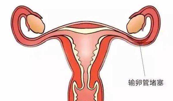广州正规助孕 2022广州供卵试管助孕条件参考 ‘怀男宝宝早期有什么特征最准’