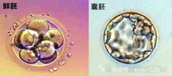 广州找妇女代怀|要不要养囊？广州试管囊胚移植的5个理由