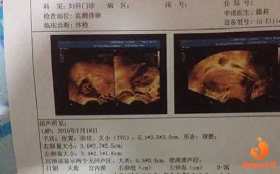 广州哪个代孕公司好|广州中山医院试管婴儿如何？试管婴儿技术成功率高吗